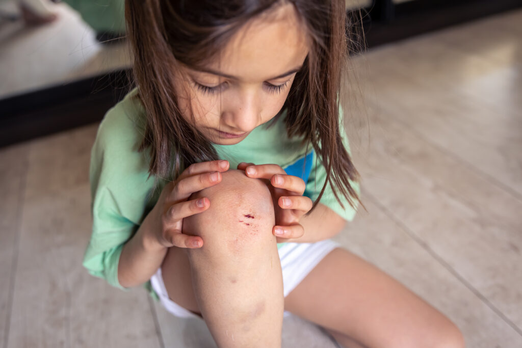 Niña con una herida abierta en la rodilla.